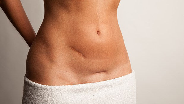 GOAL ACHIEVING - SCAR DISAPPEARING!