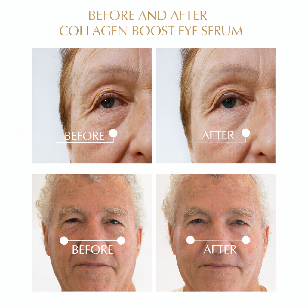 Collagen Boost Eye Serum Treatment