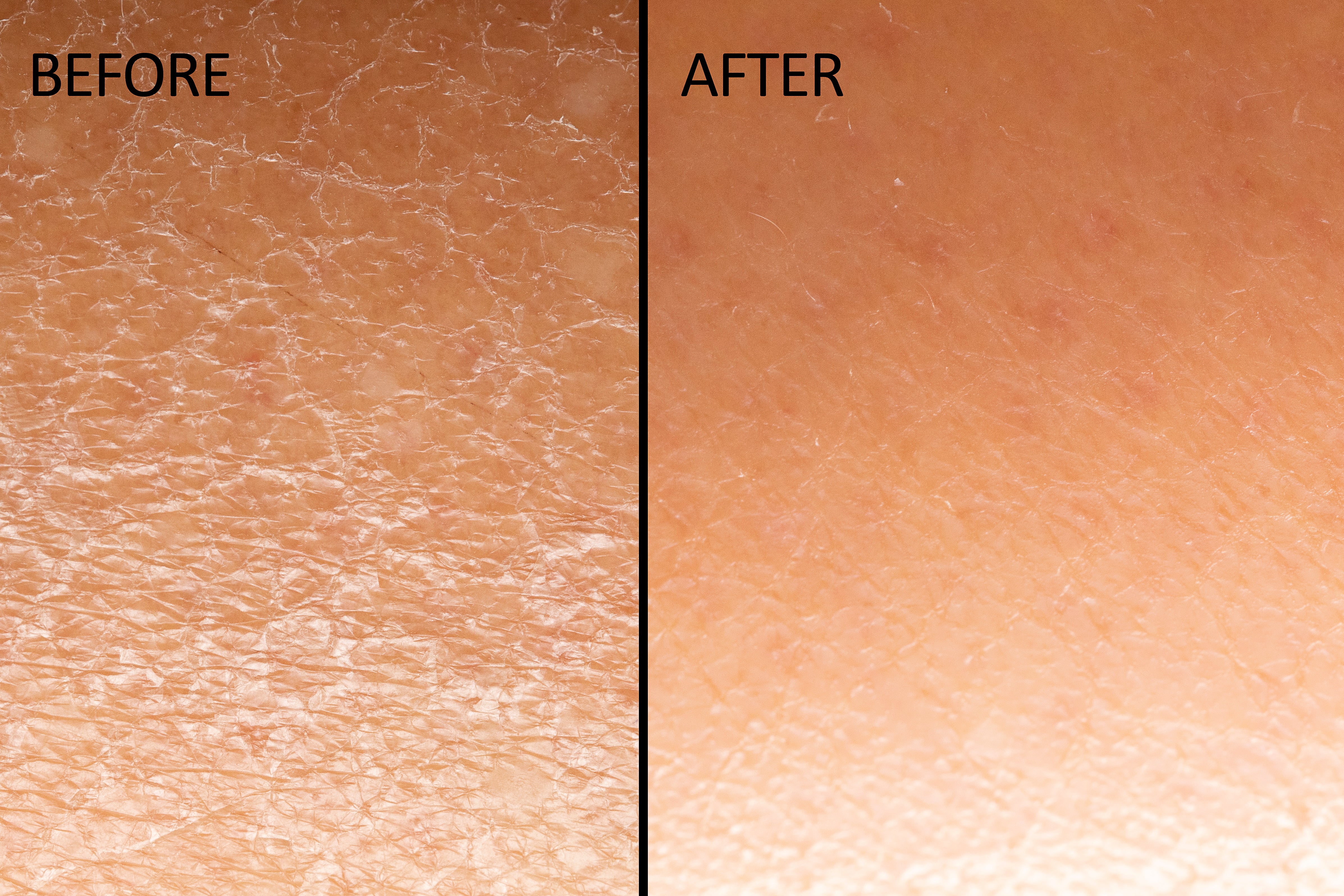 Ultra Exfoliating Body Treatment