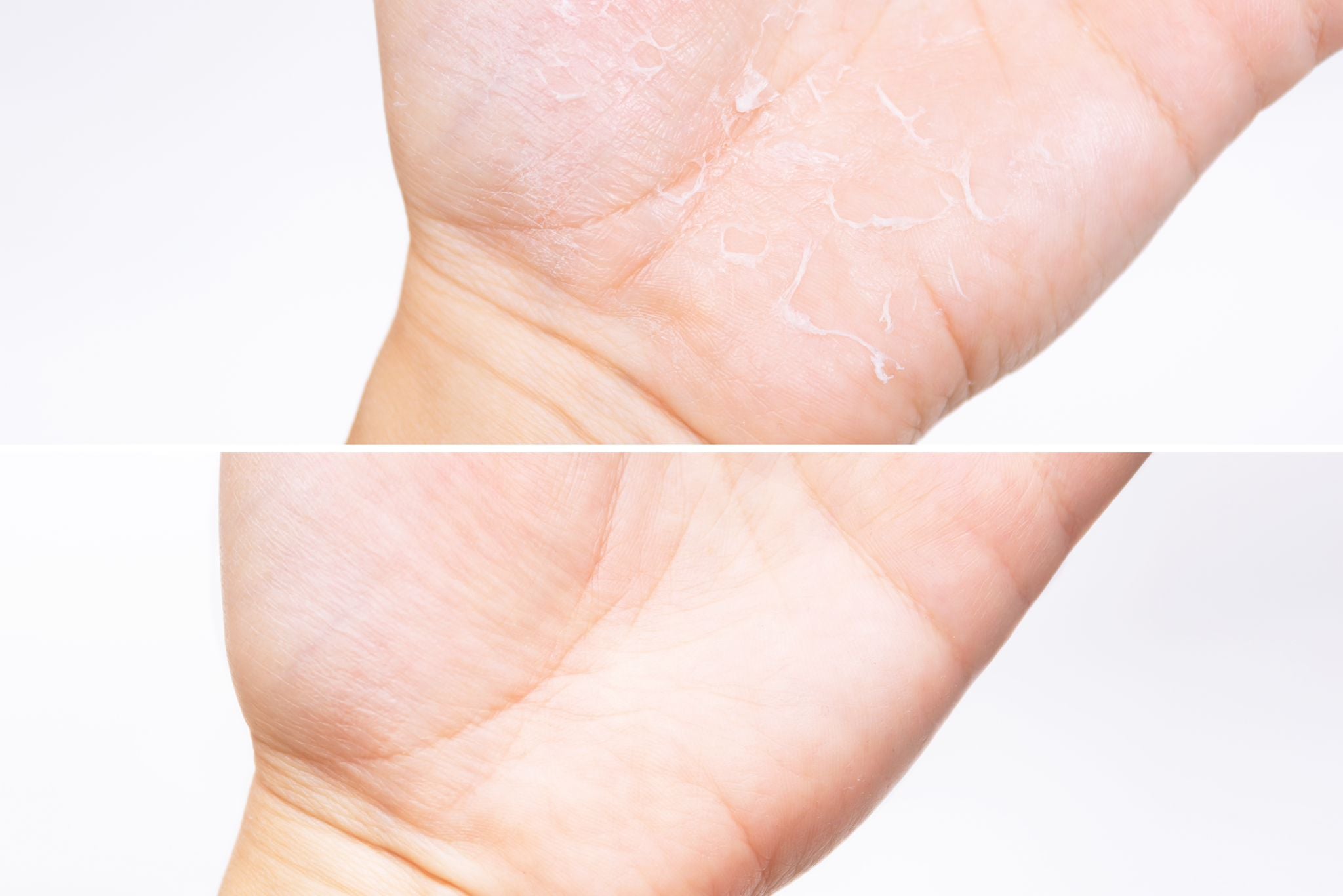 Intensive Mineral Hand Treatment