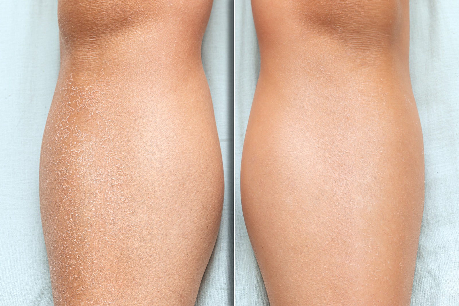Ultra Exfoliating Body Treatment Classic Formula