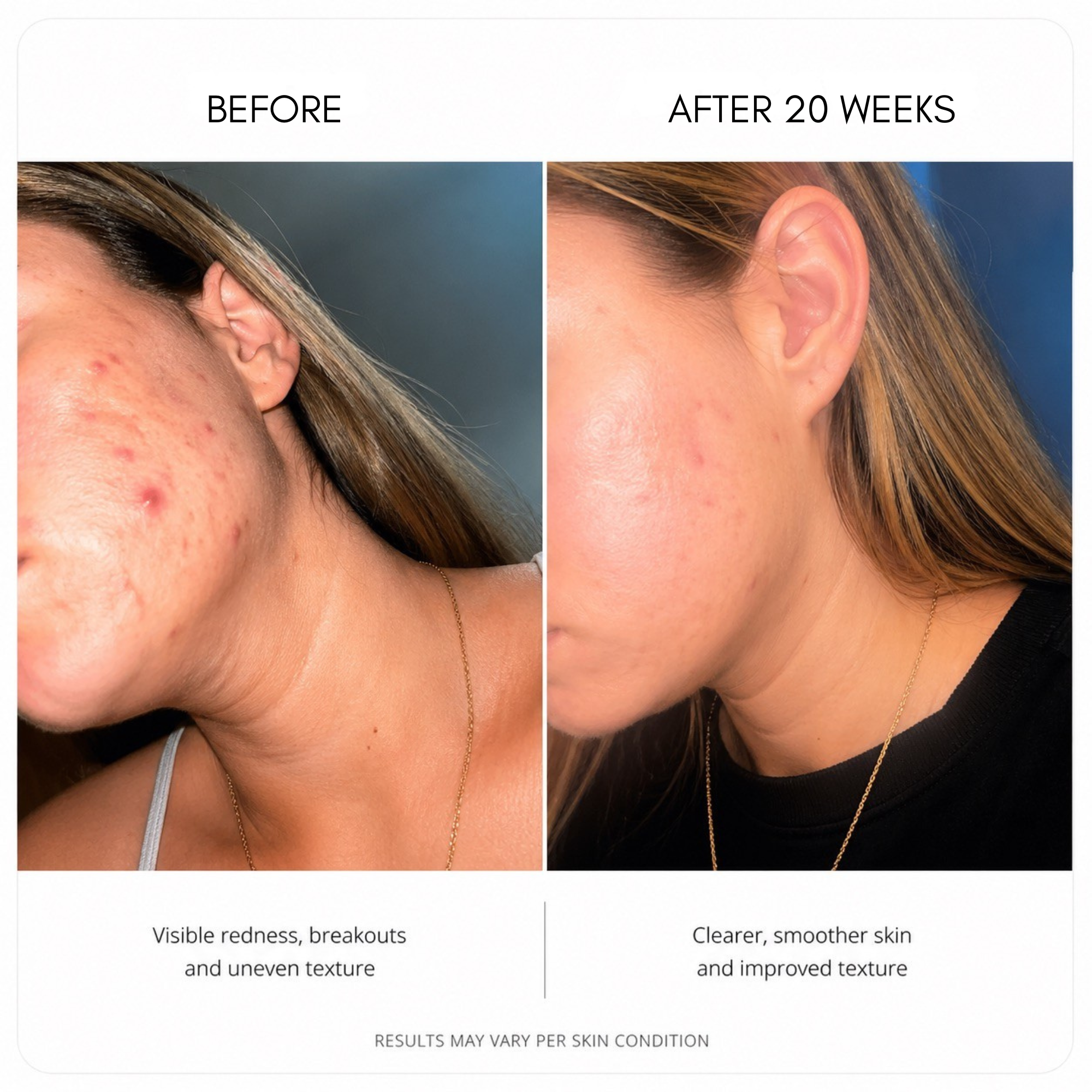 Radiance Renewal Serum