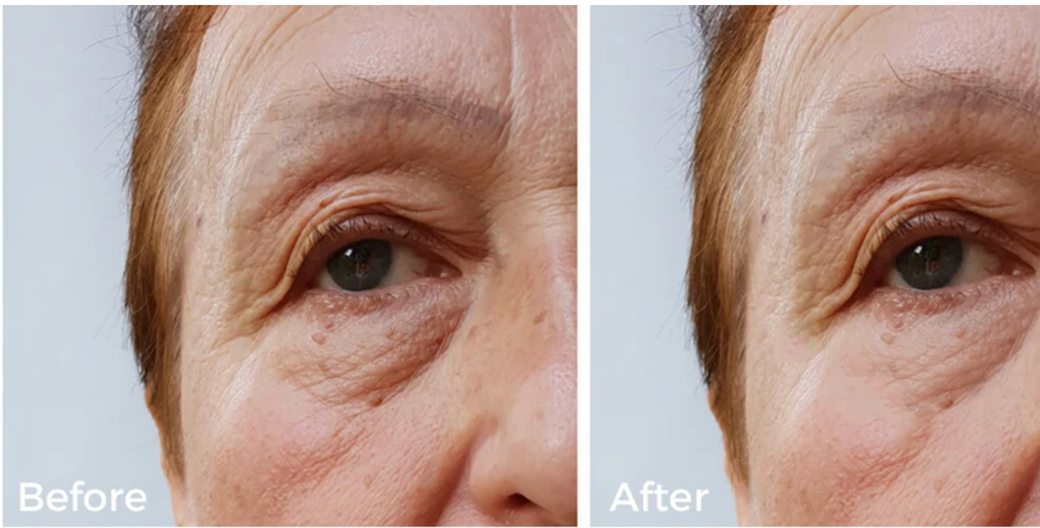 Instant Repair Collagen Eye Cream