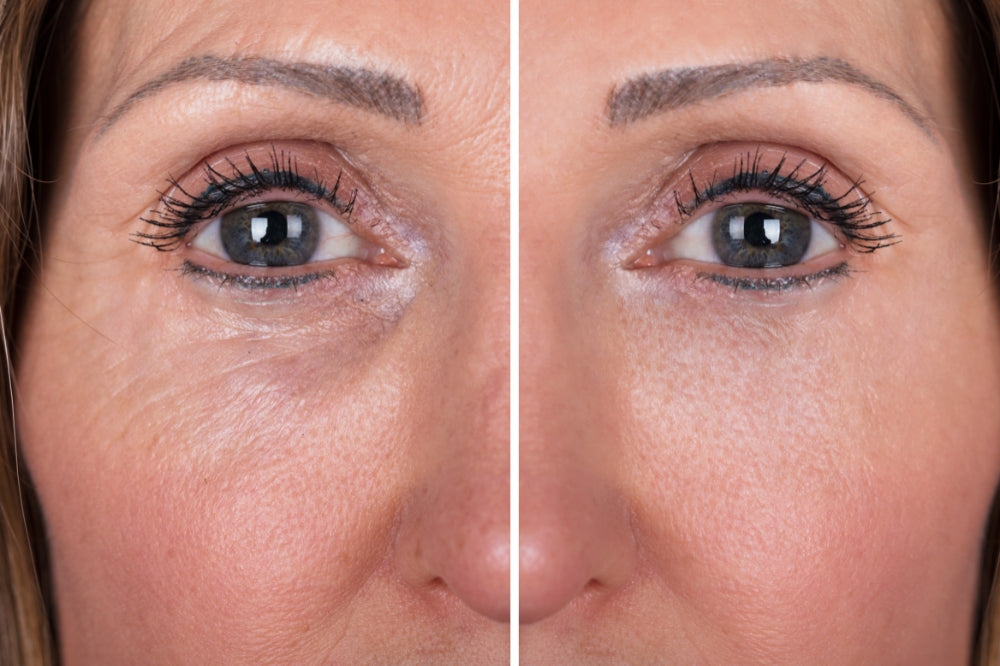The Corrective Night and Day Eye Duo