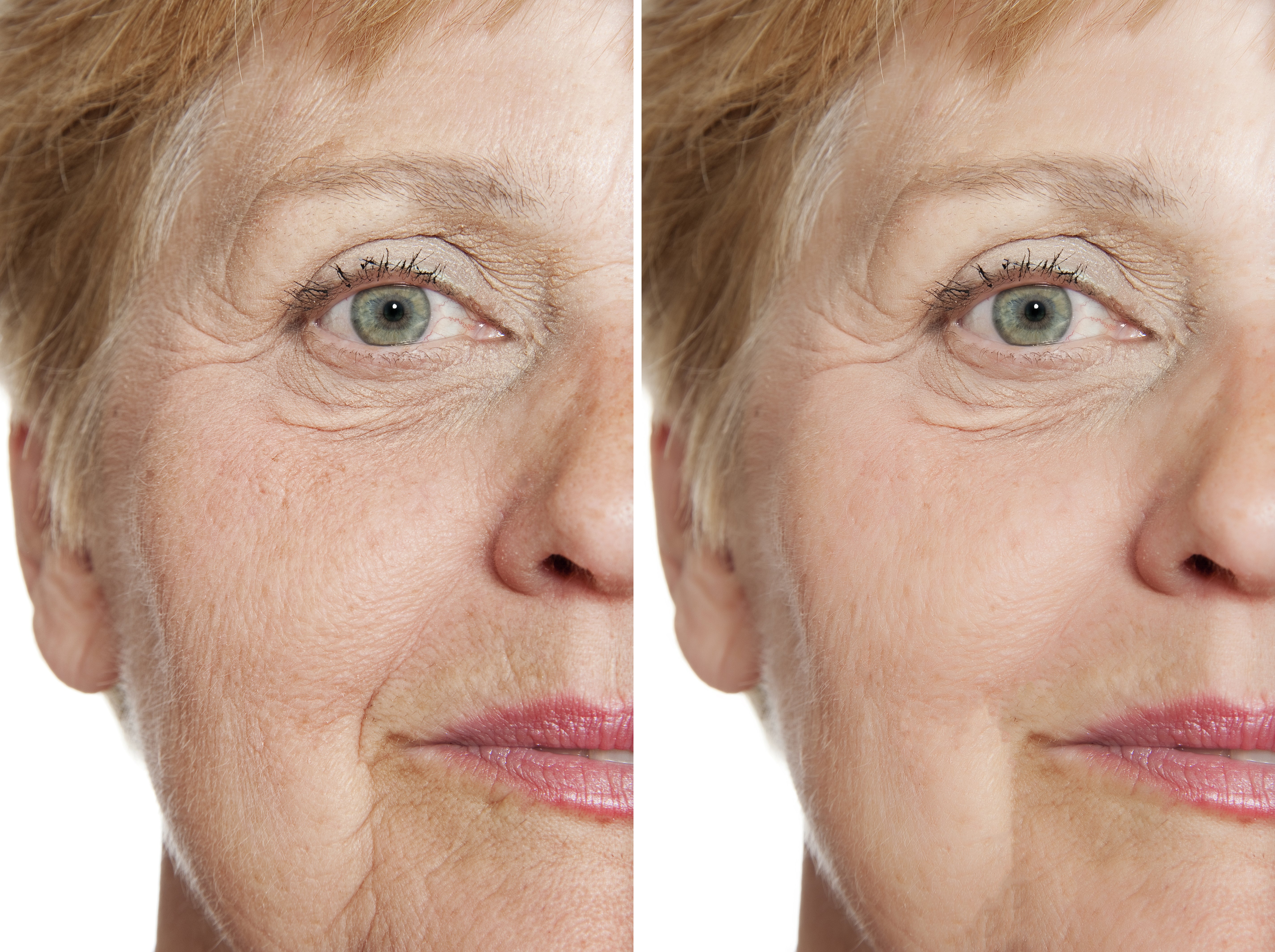 The Collagen Transformation Set